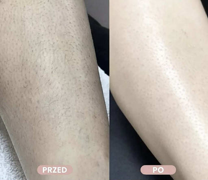 Trimella - Golarka do ciała