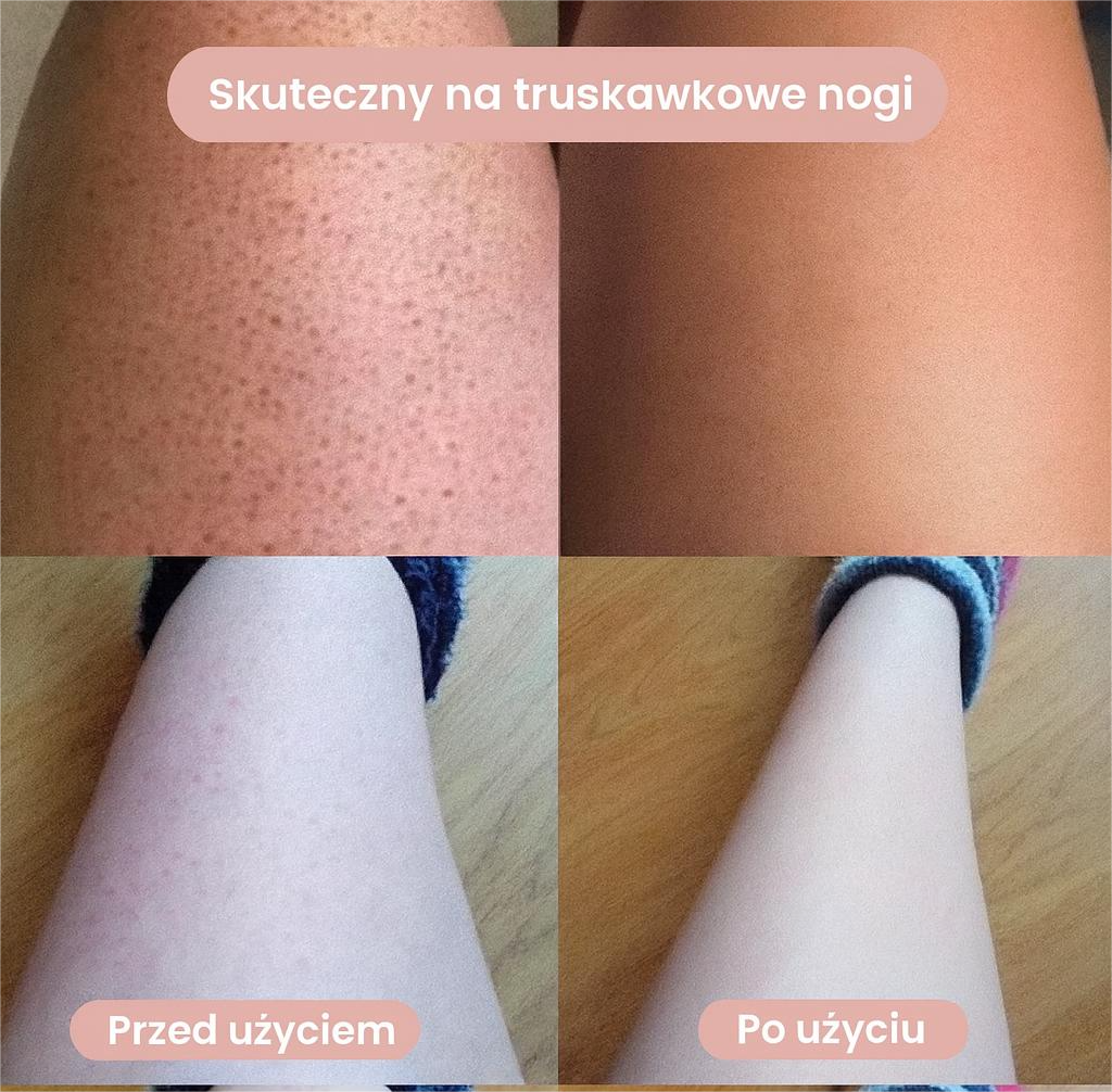 Trimella - Golarka do ciała